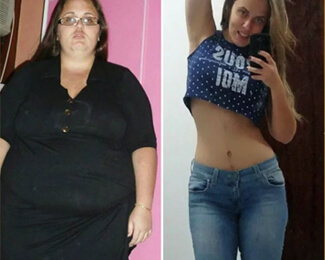 Nadine vor und nach Anwendung